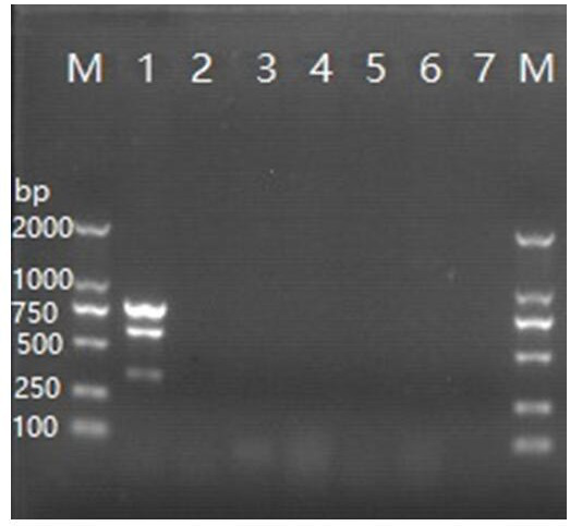 A detection primer set, detection kit and multiple PCR detection method for Streptococcus agalactiae