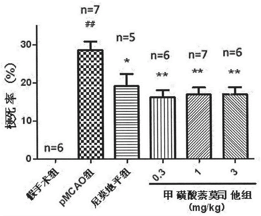 Application of nafamostat mesilate in preparing drugs for preventing and curing ischemic cerebral apoplexy