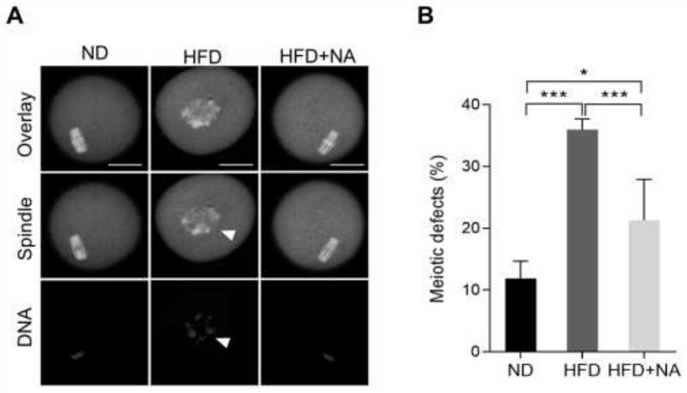 Application of nicotinic acid in preparation of medicine for treating and/or preventing fertility disorder of obese women