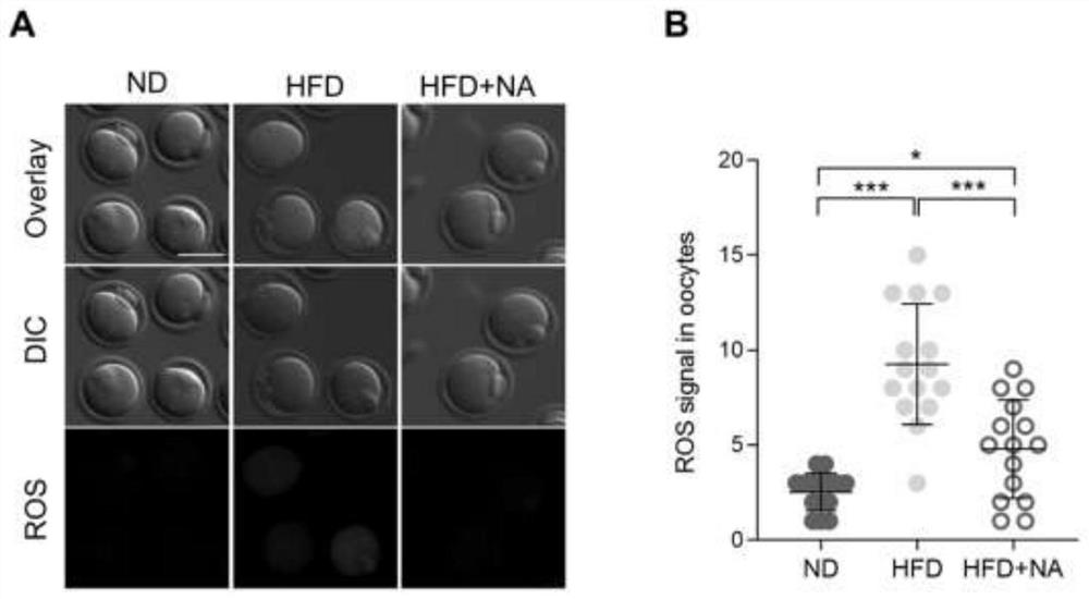 Application of nicotinic acid in preparation of medicine for treating and/or preventing fertility disorder of obese women