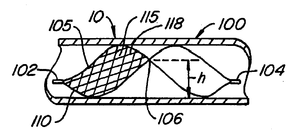 Lumen filtering methods