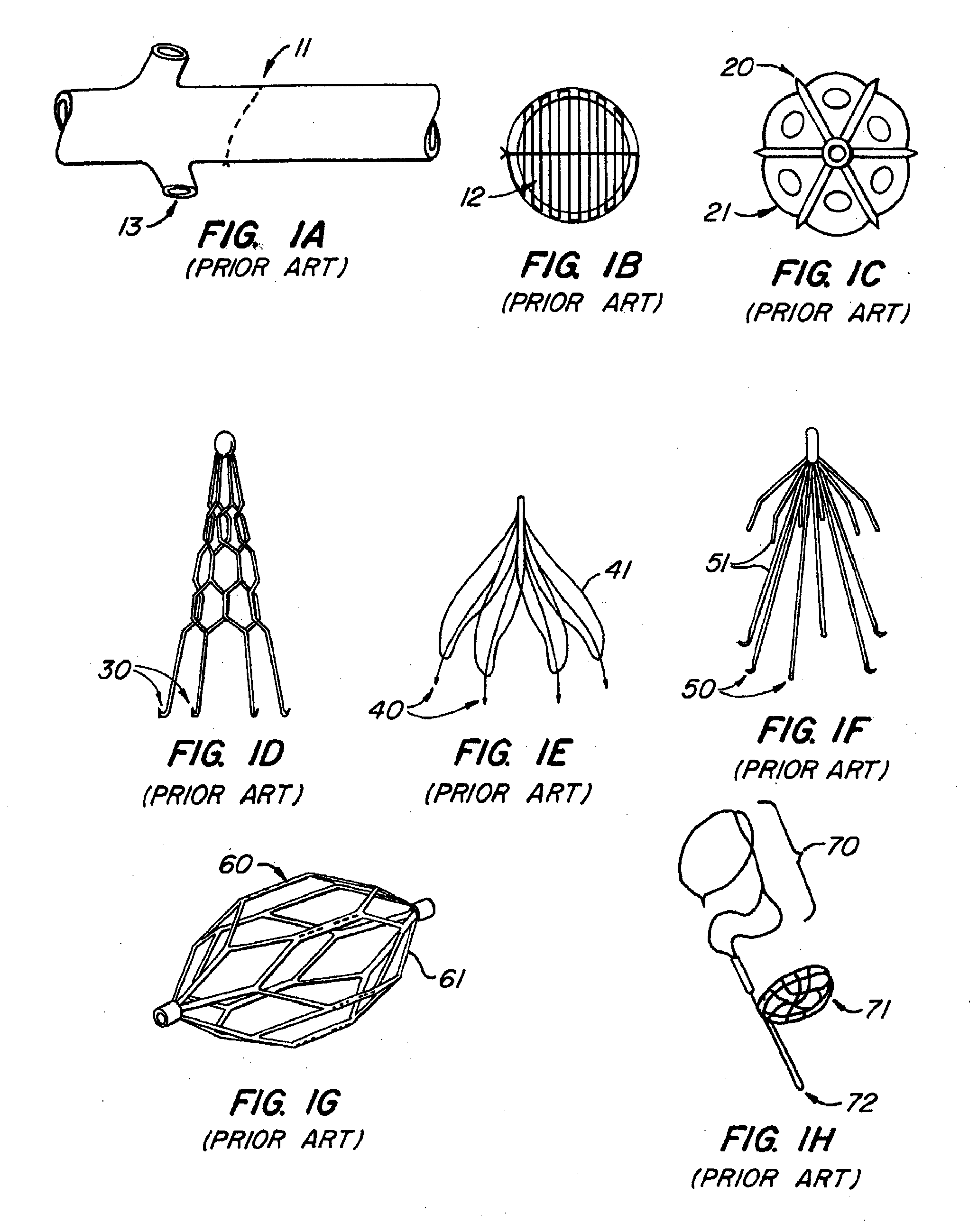 Lumen filtering methods