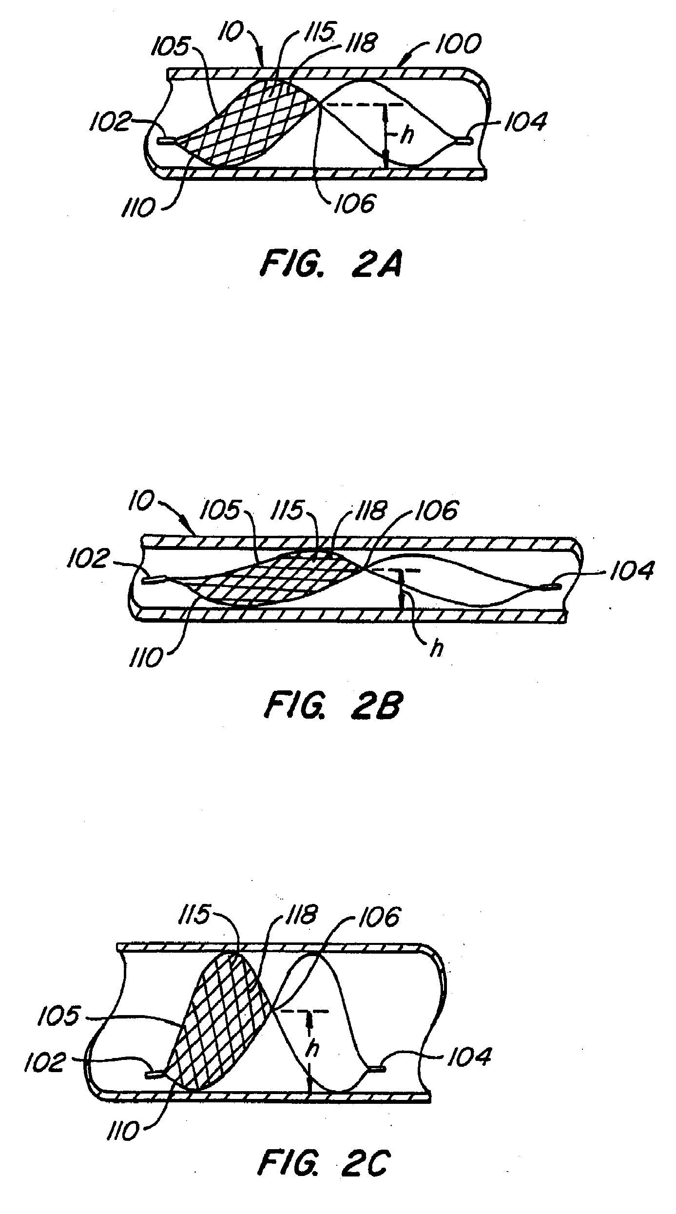 Lumen filtering methods