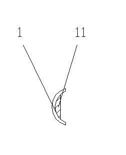 Backbone internal fixing system