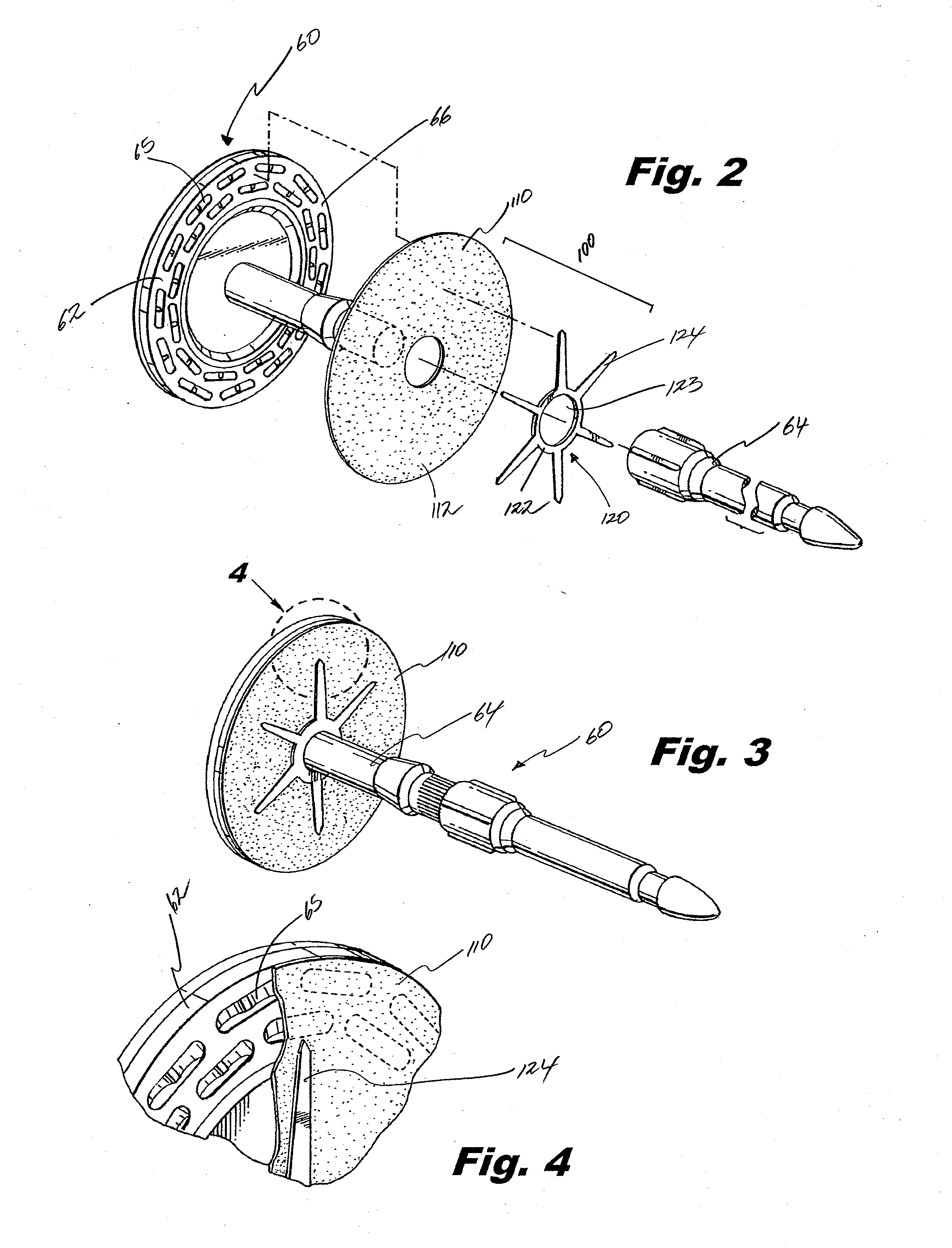 Buttress Support Design For EEA Anvil