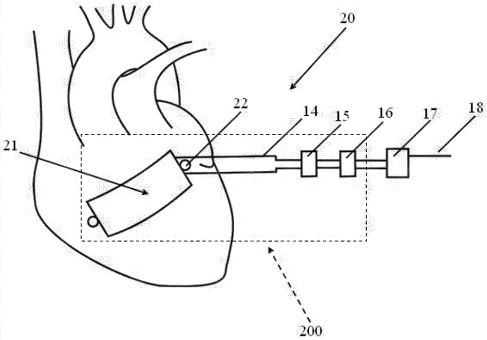 Self-energized bladder pacemaker