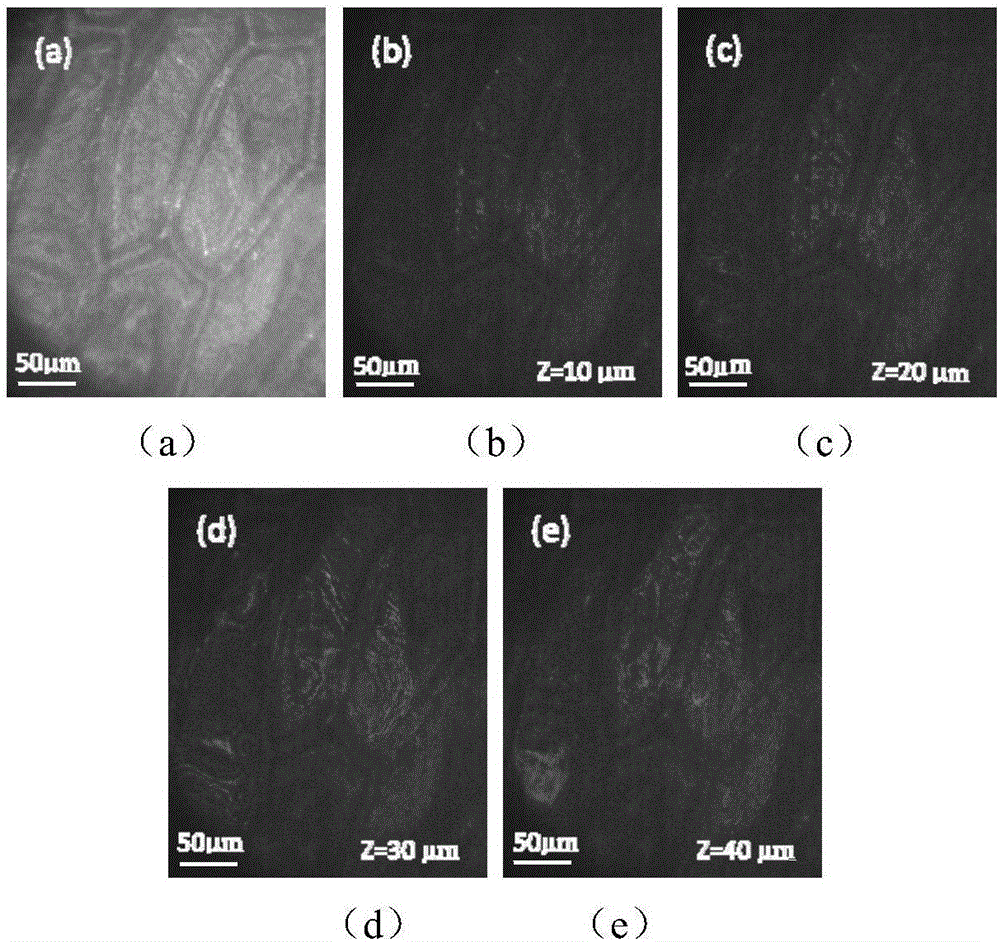 Tandem type full-field optical tomography imaging device and method based on compensation interferometer