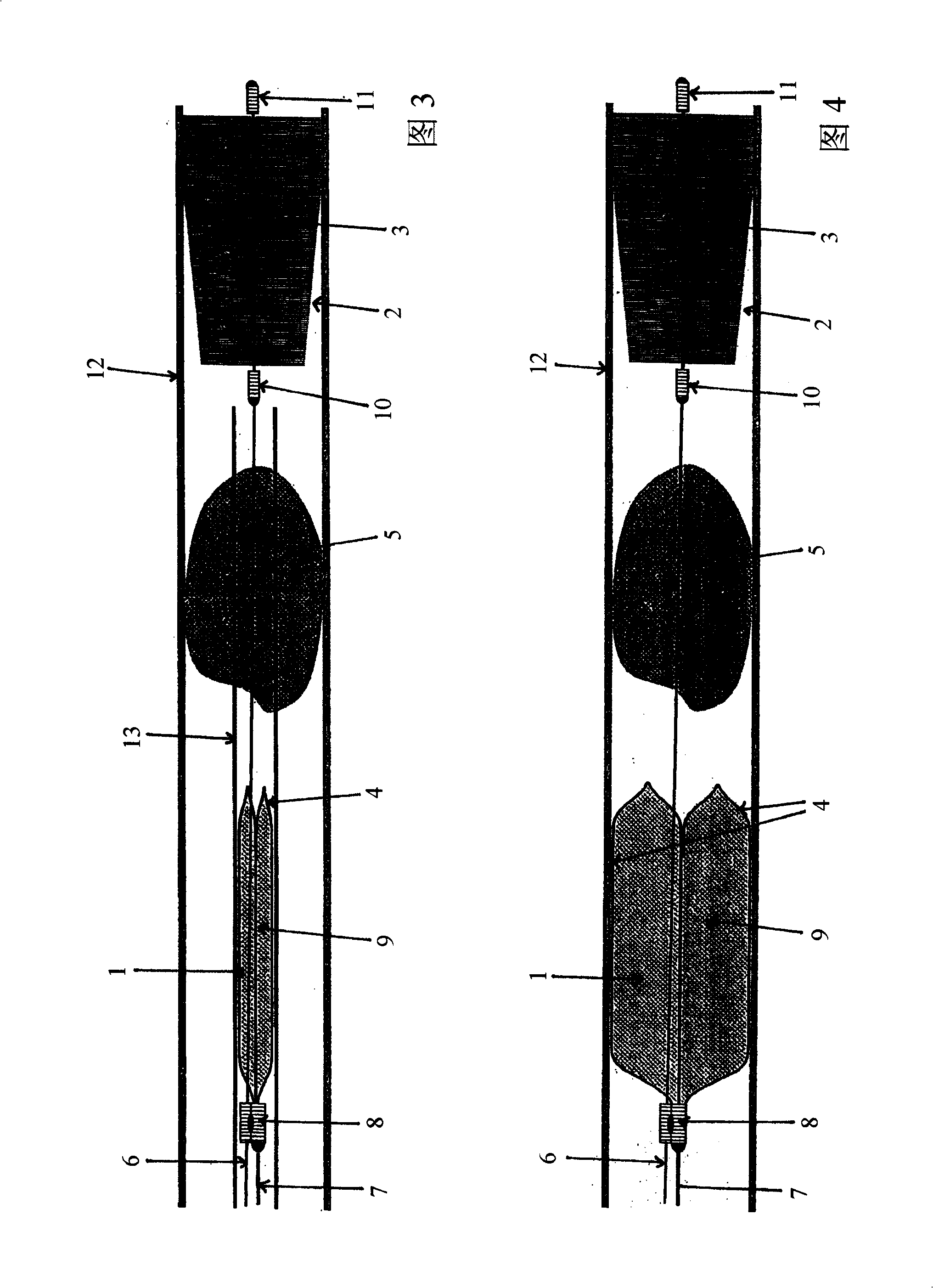 Device for the removal of thrombi from blood vessels