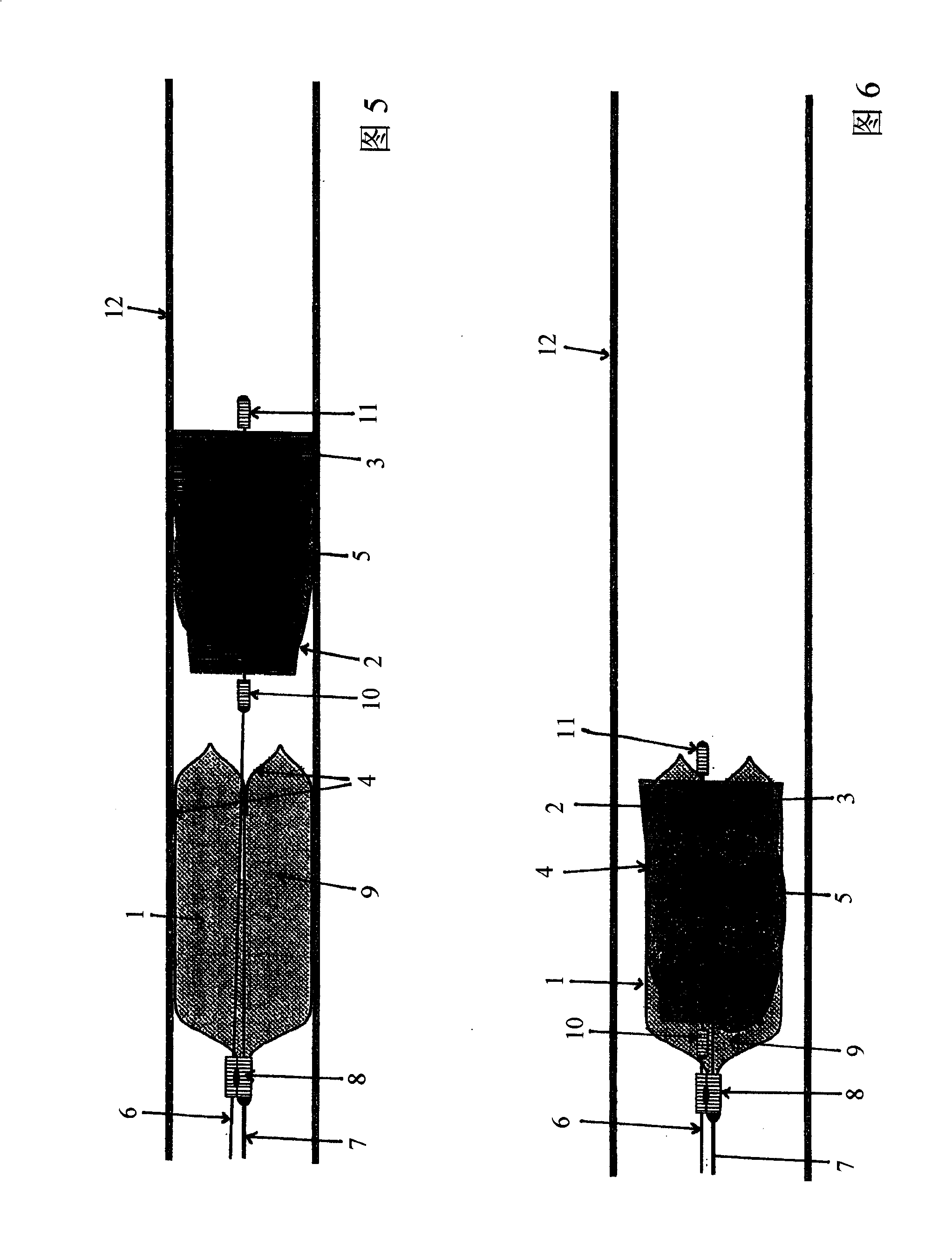 Device for the removal of thrombi from blood vessels