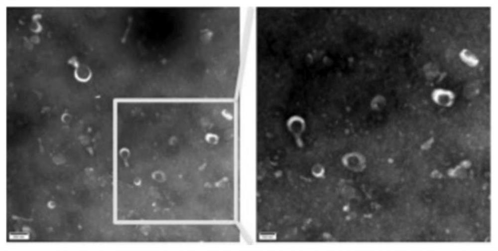 Extracellular matrix gel carrying mesenchymal stem cell exosome and preparation method thereof