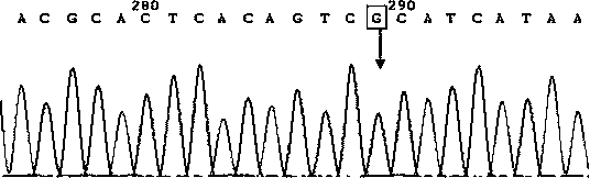 In-vitro diagnostic kit of Leber hereditary optic neuropathy