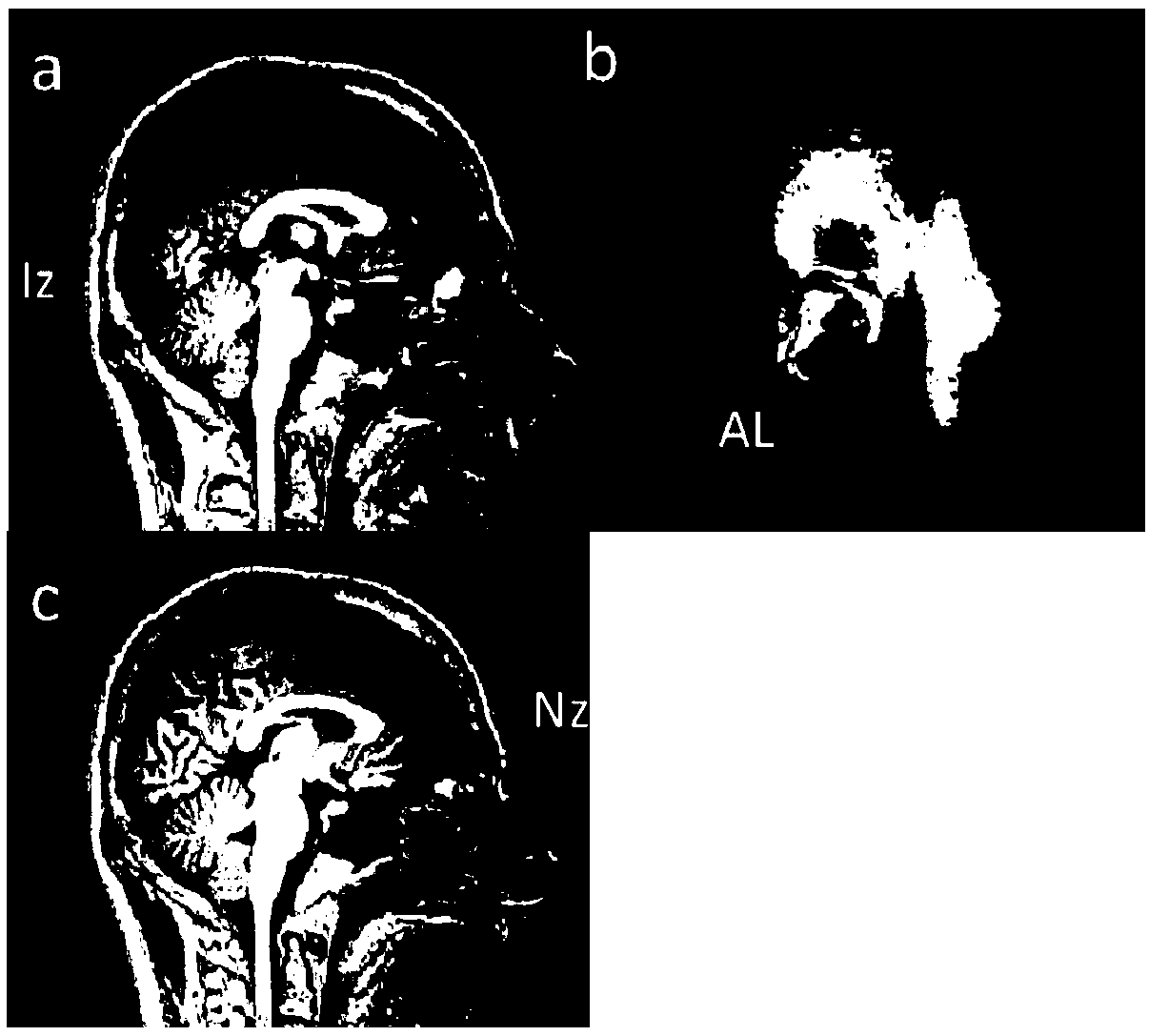 Individual transcranial brain map generation method based individual characteristics, navigation method and system thereof