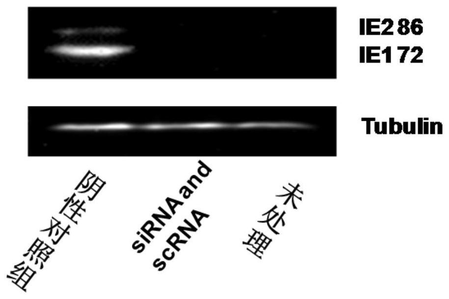 Small nucleic acid for inhibiting human cytomegalovirus infection as well as preparation and application thereof