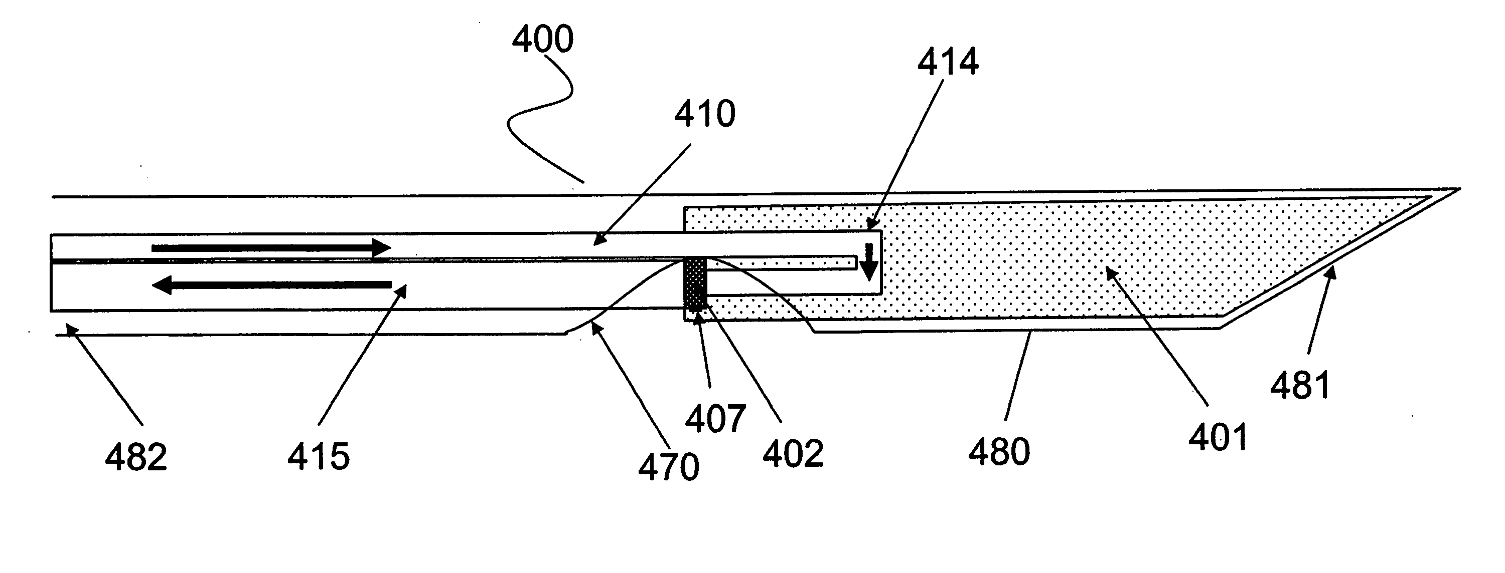 Implantable biosensor and methods of use thereof