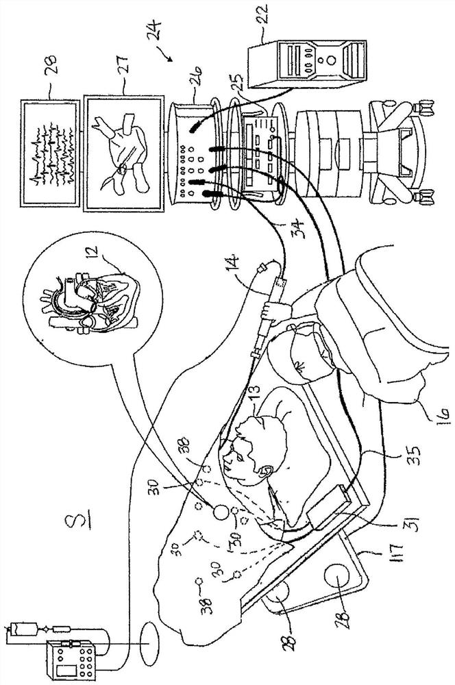 Systems and methods for controlling catheter power based on contact force