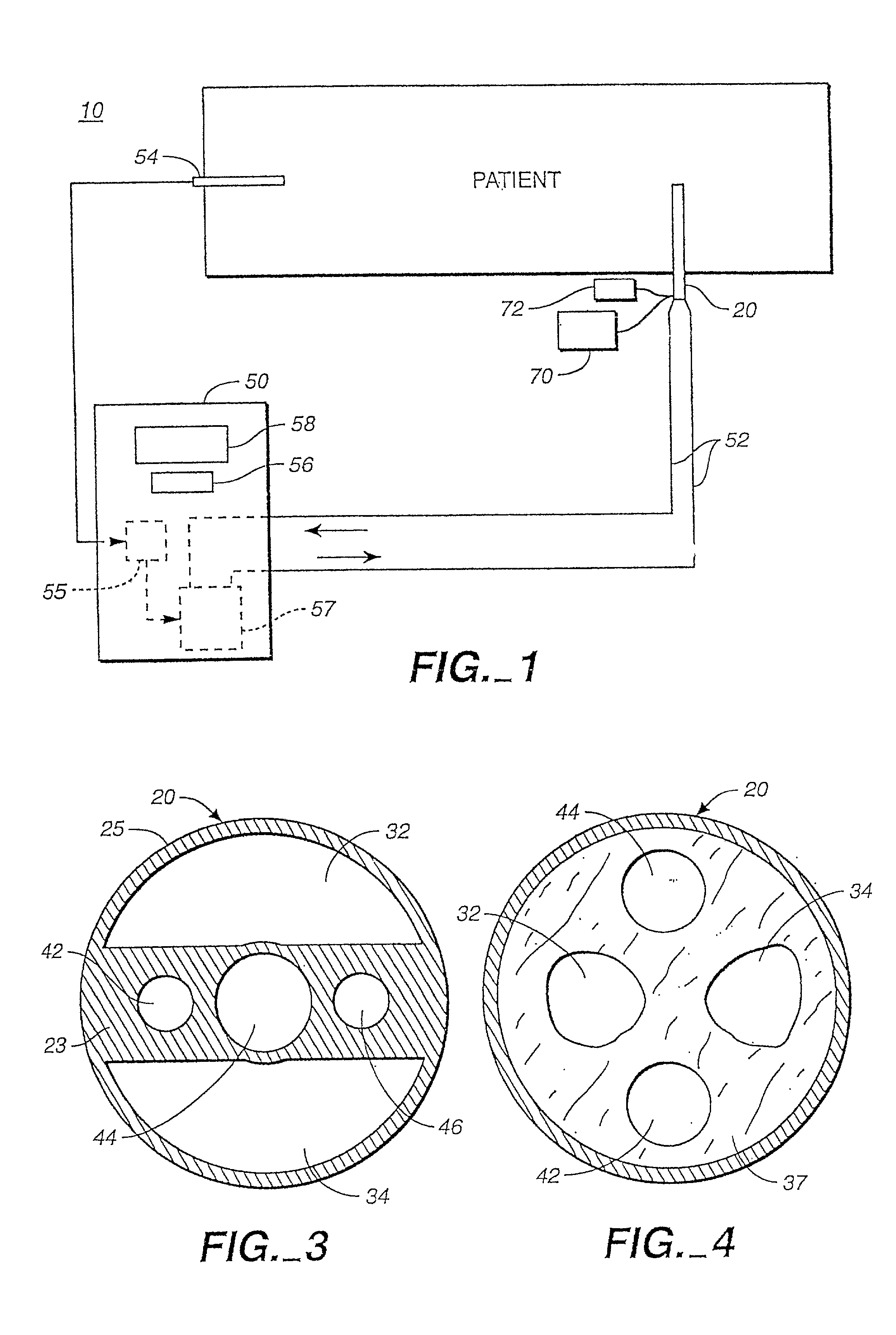 Method for a central venous line catheter having a temperature control system