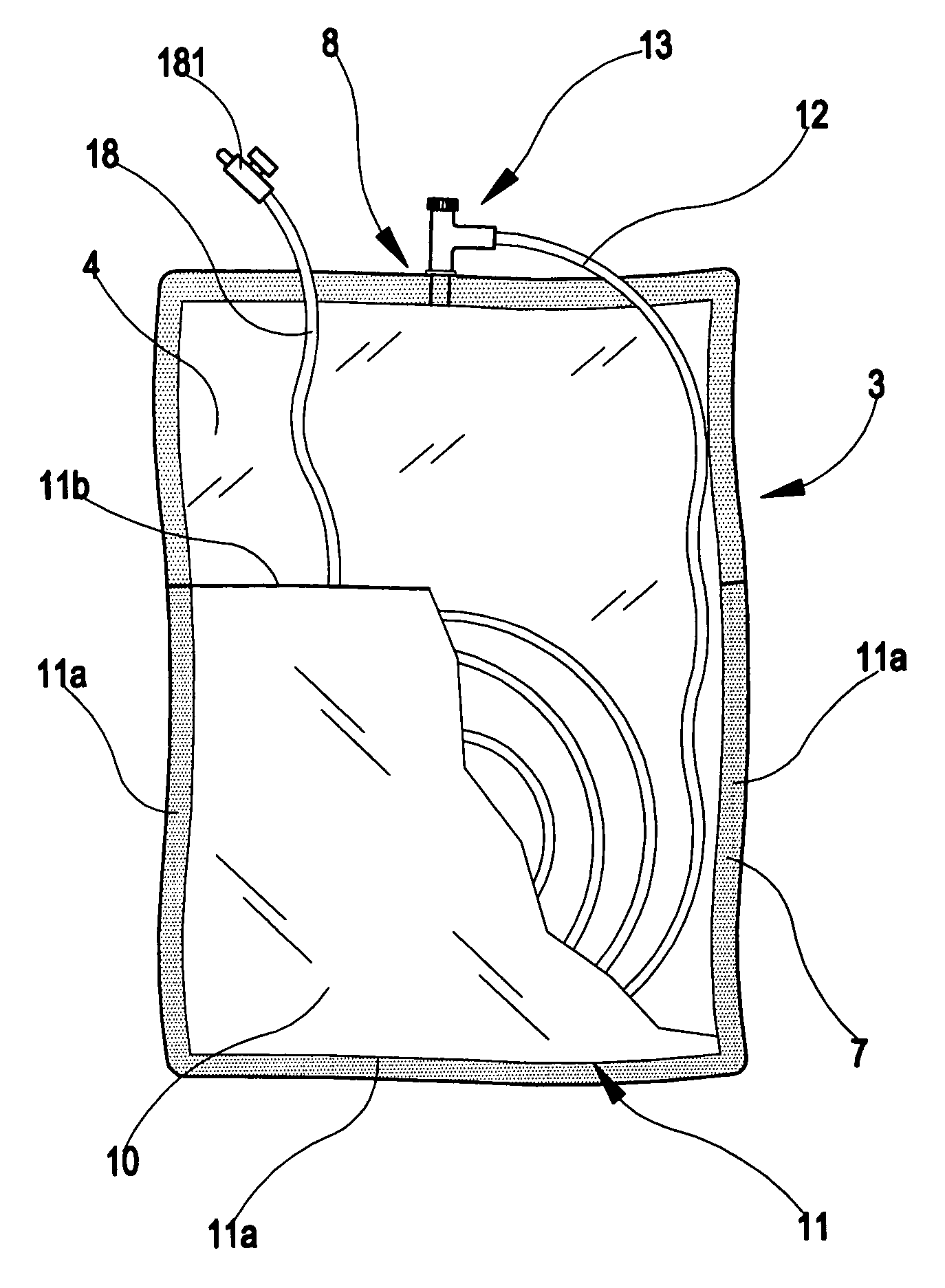 Dialysis bag, a dialysis set comprising the bag, and a three-way connector for access to a dialysis bag