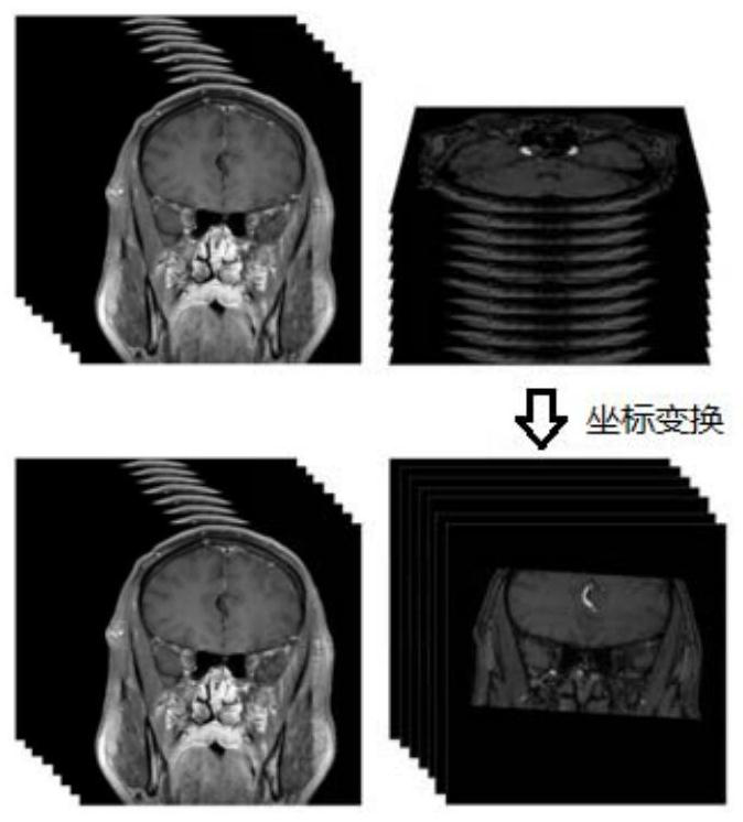 Method for establishing intracranial vessel simulation three-dimensional stenosis model based on transfer learning