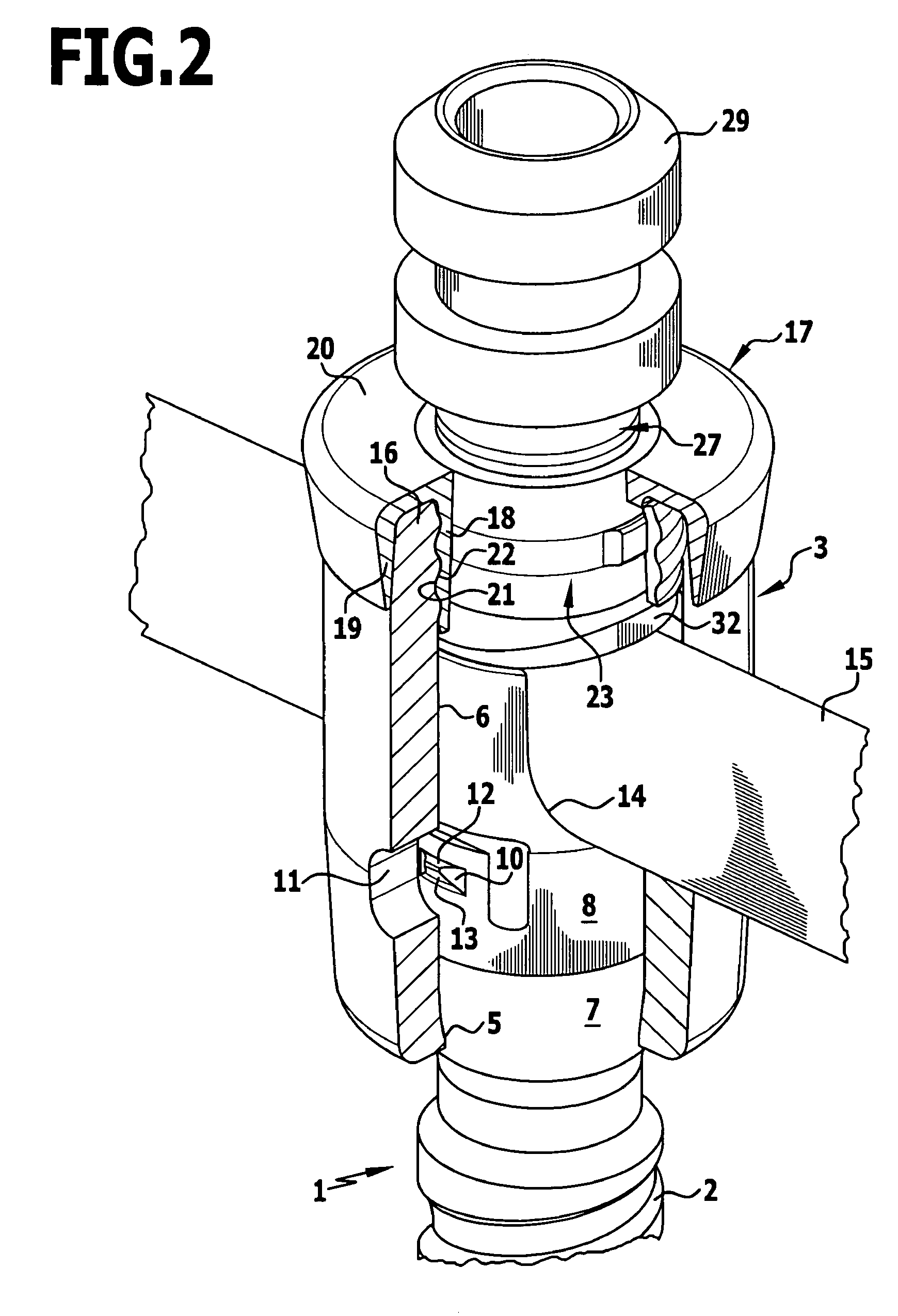 Orthopedic retaining system