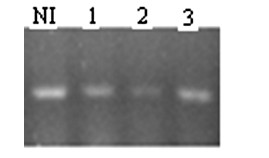 Nucleic acid molecule macrophage inflammatory protein (MIP) 3 alpha antibody to nuclear antigen (ANA) 6 and application thereof to preparation of immunosuppressive medicaments