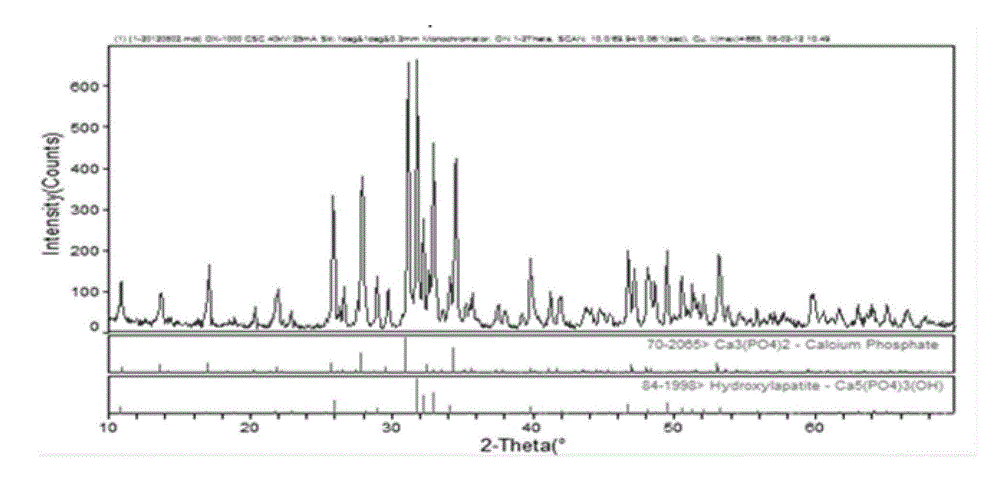 Preparation method of plga modified biofactor-loaded microsphere bone substitute material