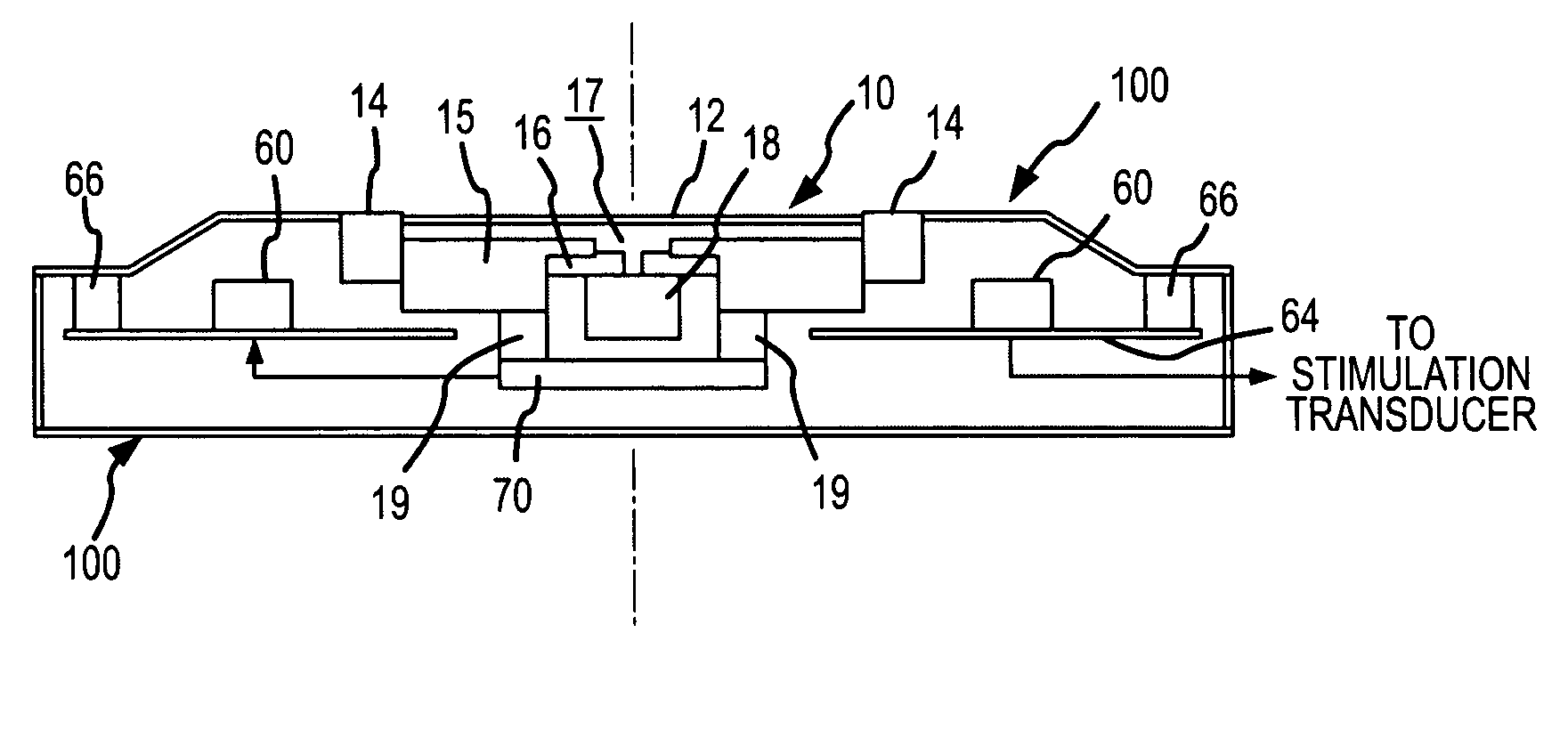 Active vibration attenuation for implantable microphone