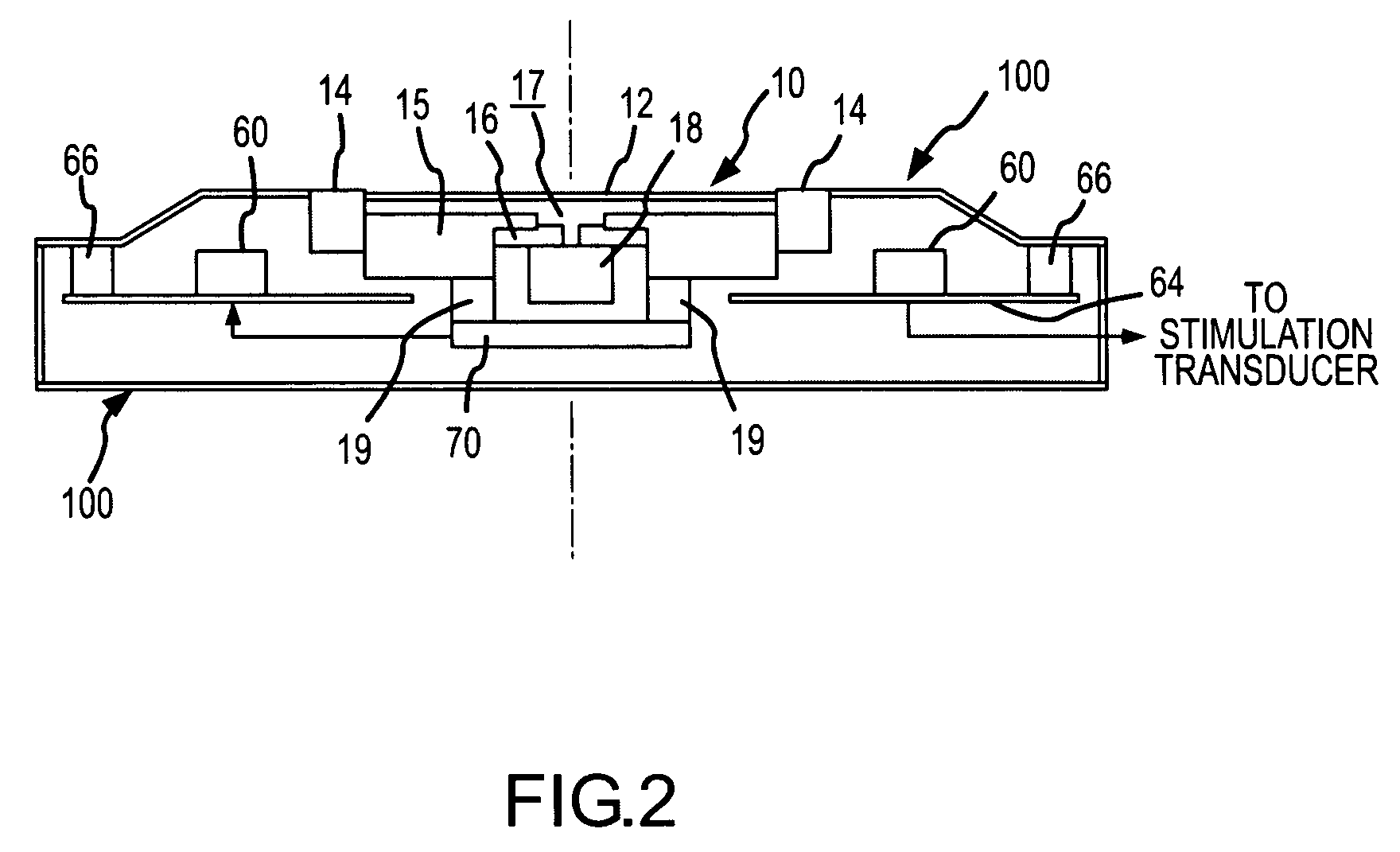 Active vibration attenuation for implantable microphone