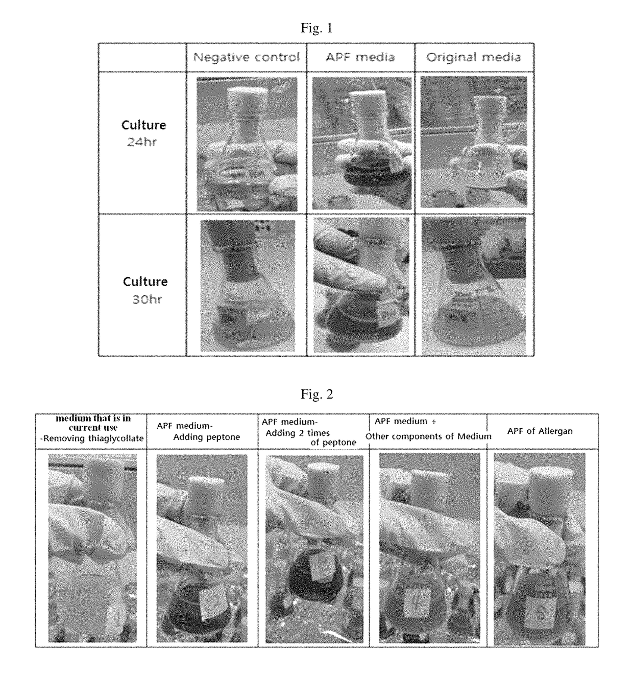 Medium composition for preparing botulinum toxin