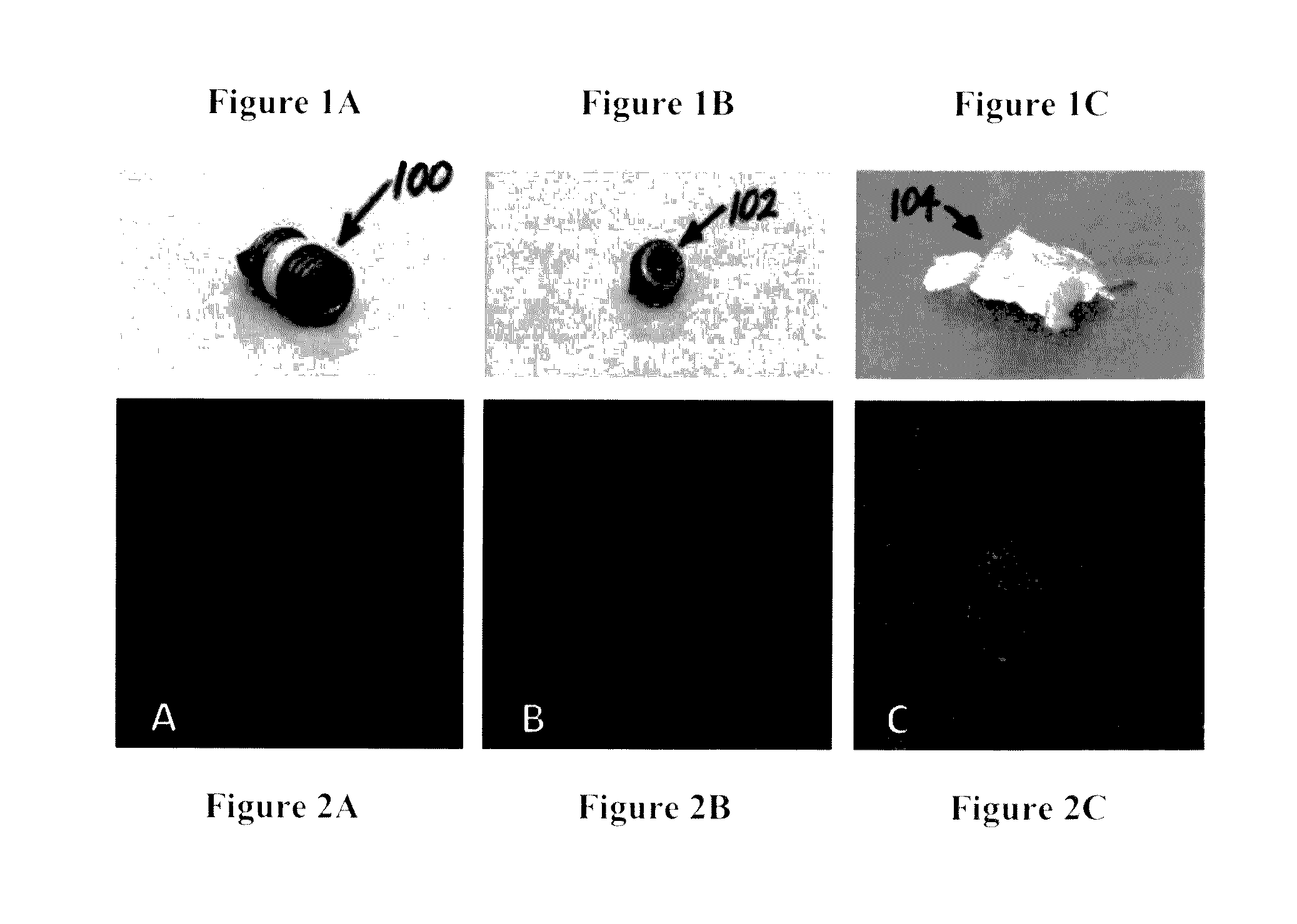 Visualization of bacterial colonization and biofilm formation on orthopaedic trauma explants