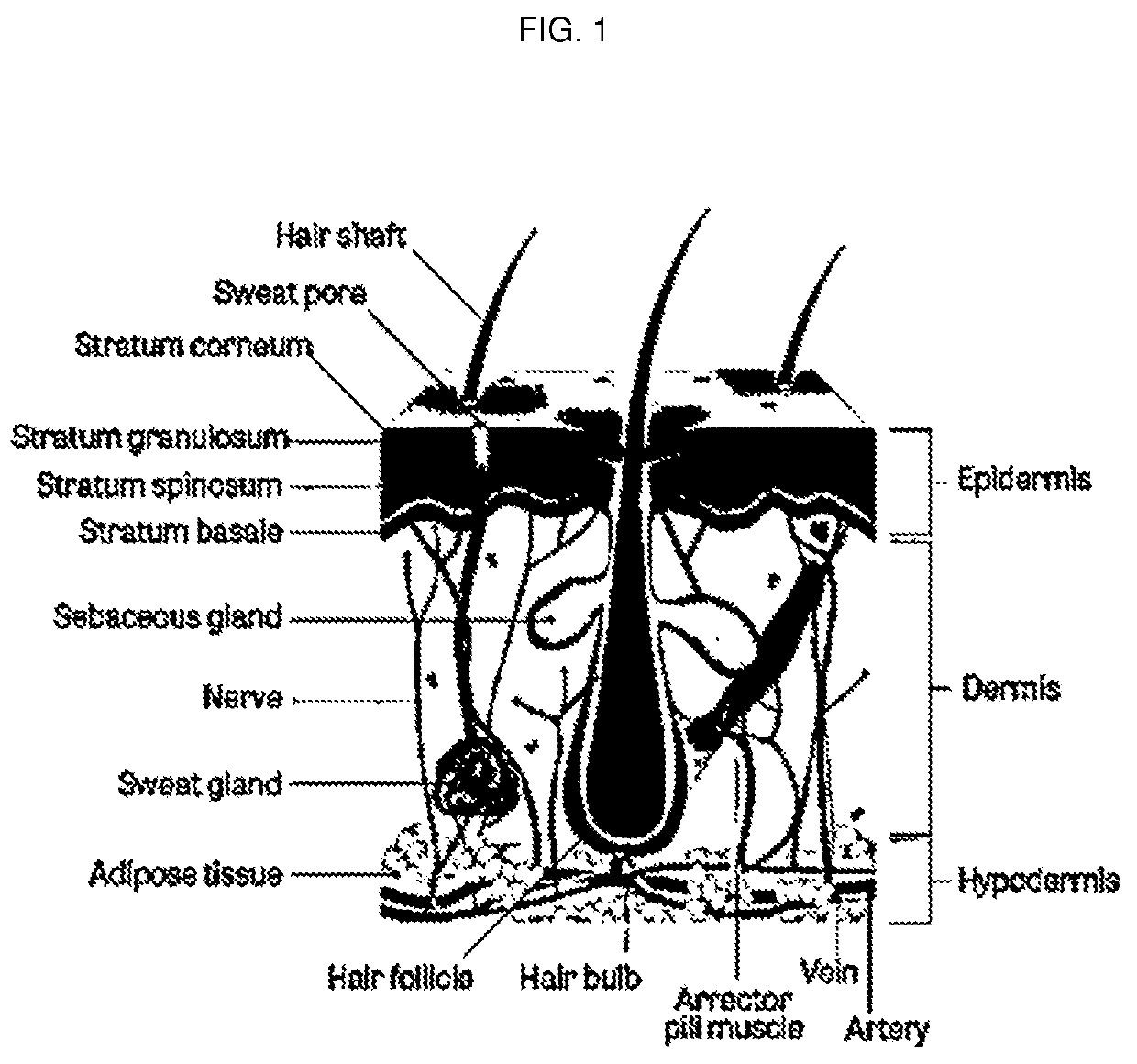 Topical dutasteride emulsions for treating endocrine therapy-induced alopecia