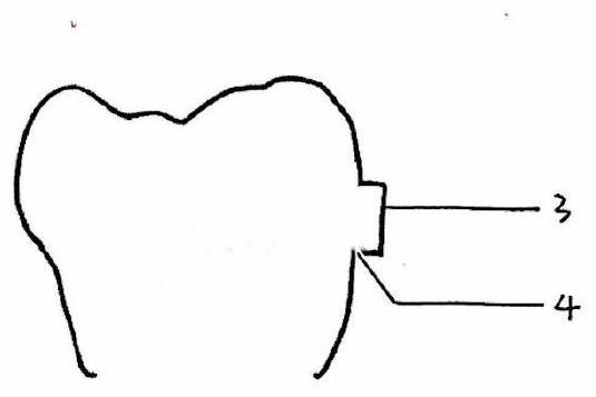 Invisible tooth socket with traction accessory and manufacturing method of invisible tooth socket