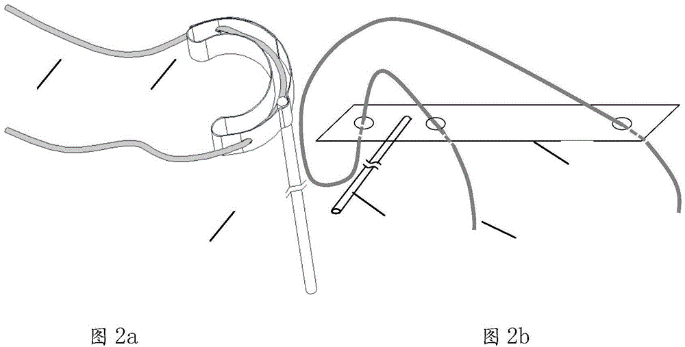 Implanted spiral electrode and manufacturing method thereof