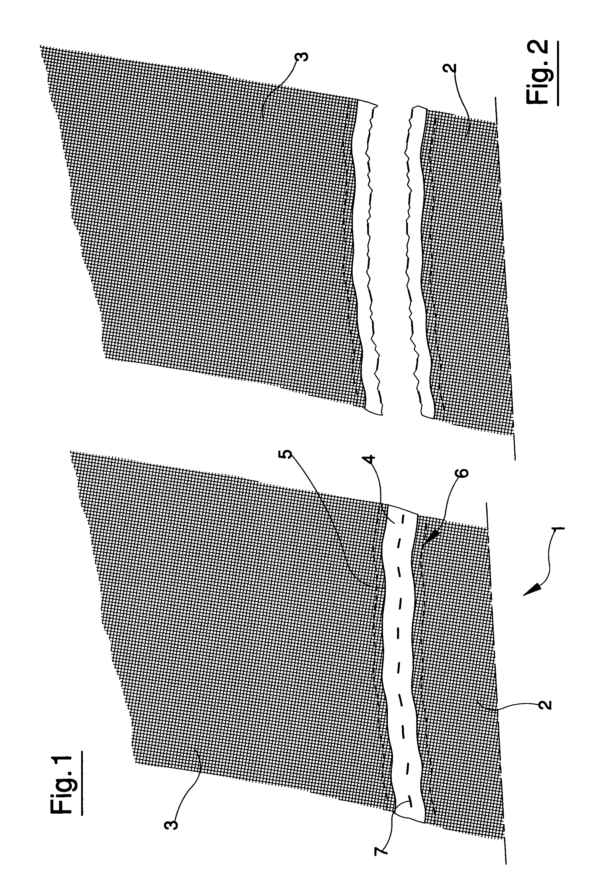 Surgical dressing with identification counterfoil