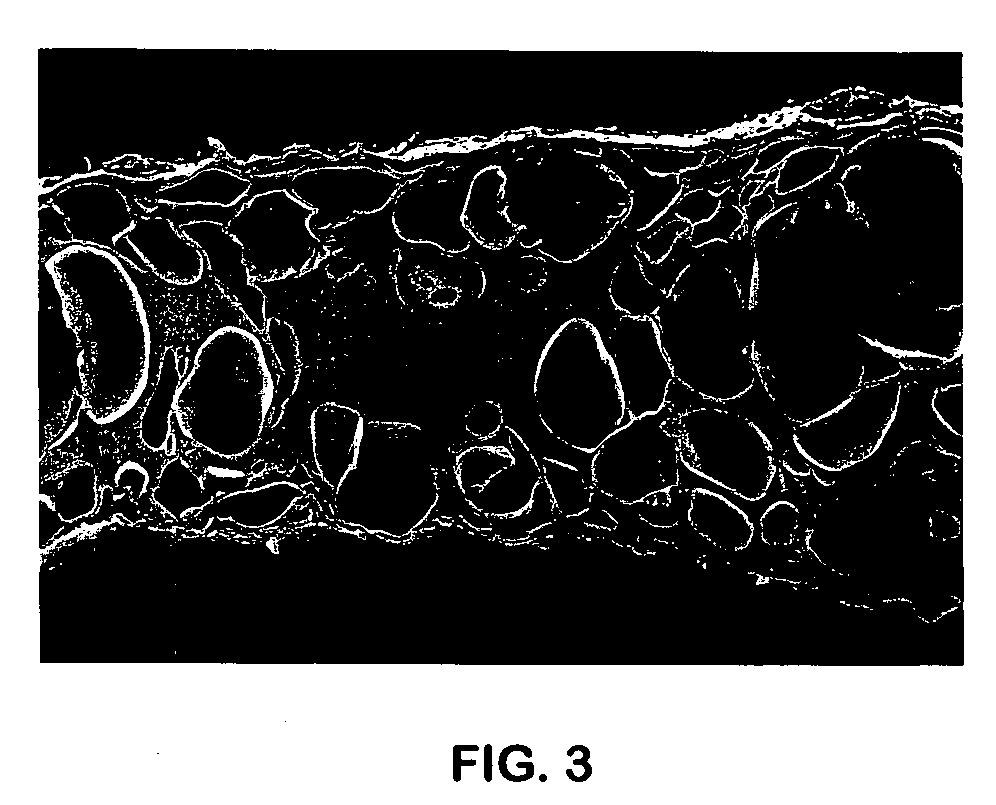 Low-density, open-cell, soft, flexible, thermoplastic, absorbent foam and method of making foam