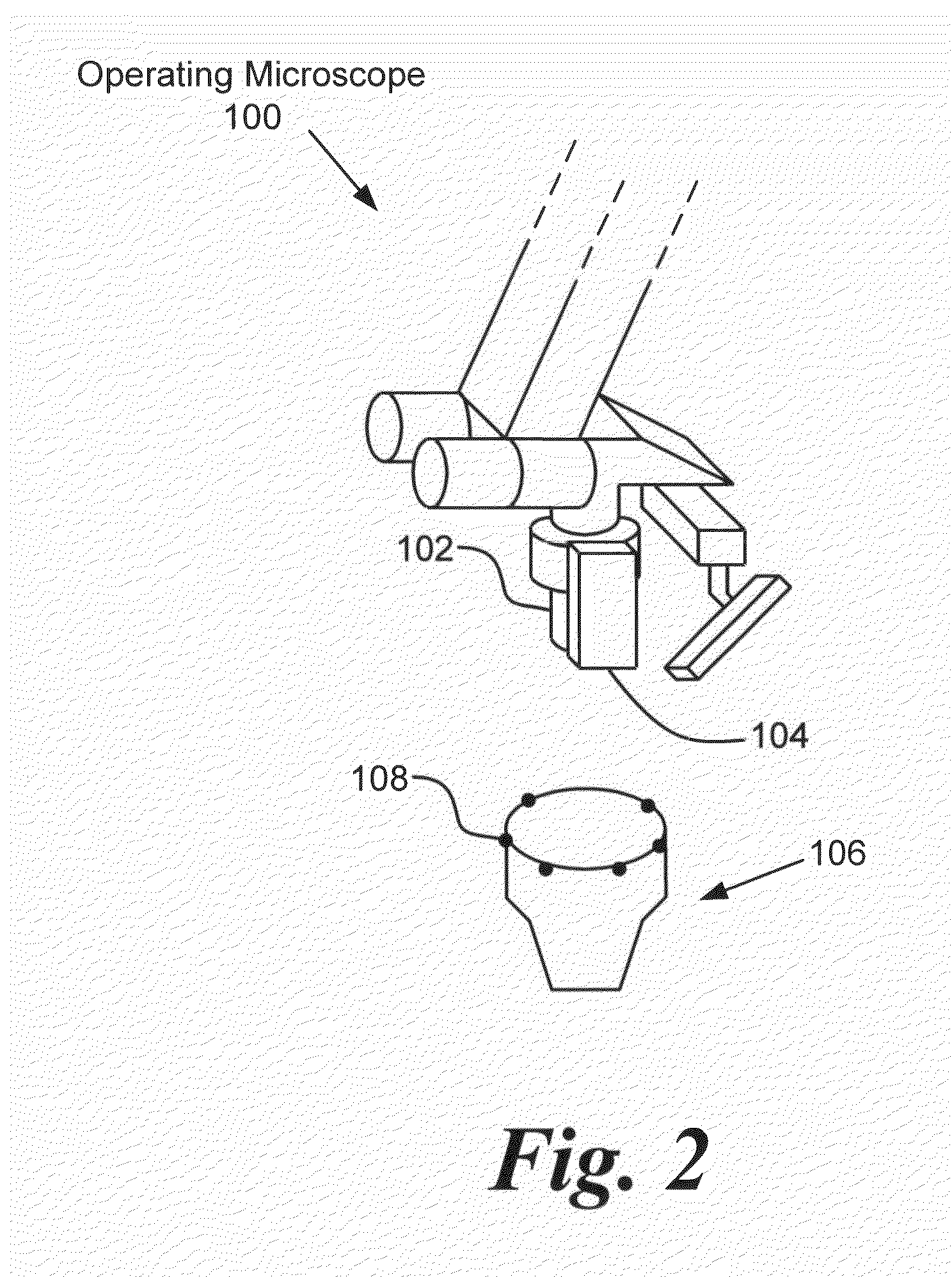 Method and instrument for surgical navigation