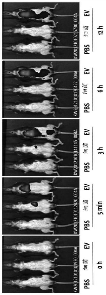 Nanovesicles derived from bacteria of genus rhodococcus, and use thereof