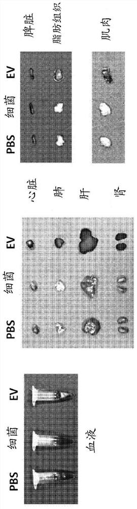 Nanovesicles derived from bacteria of genus rhodococcus, and use thereof