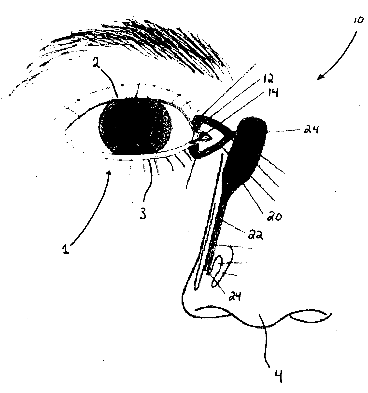 Microelectronic biosensor plug