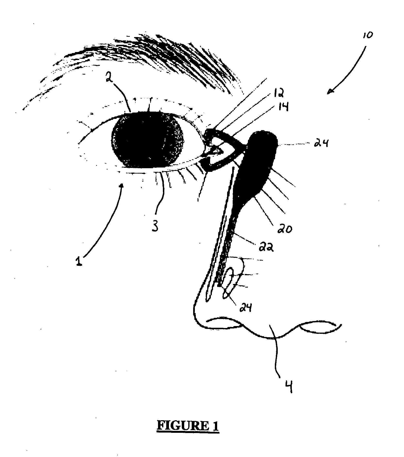 Microelectronic biosensor plug