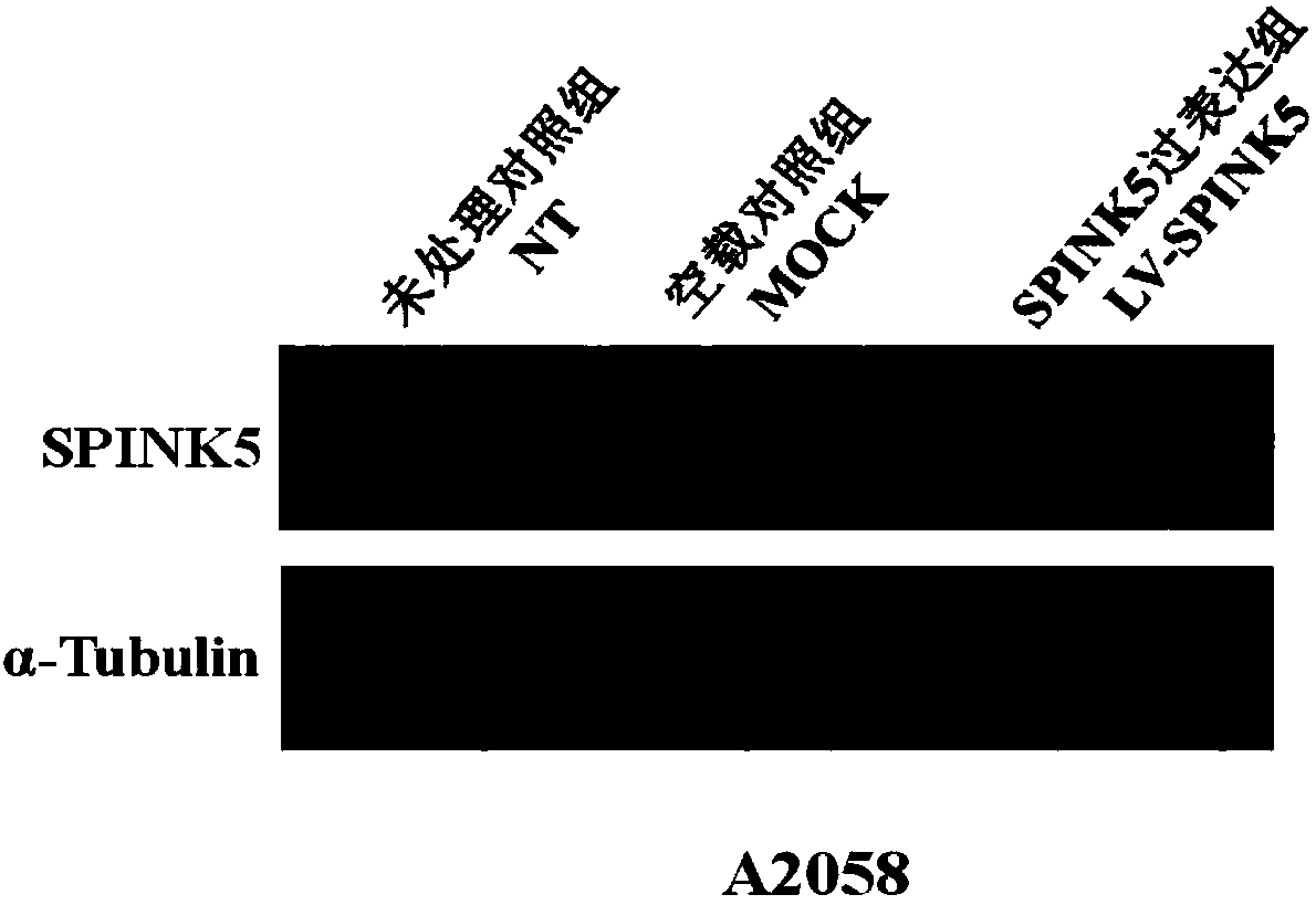 Method for constructing plasmids of recombinant human SPINK5 genes and application of plasmids