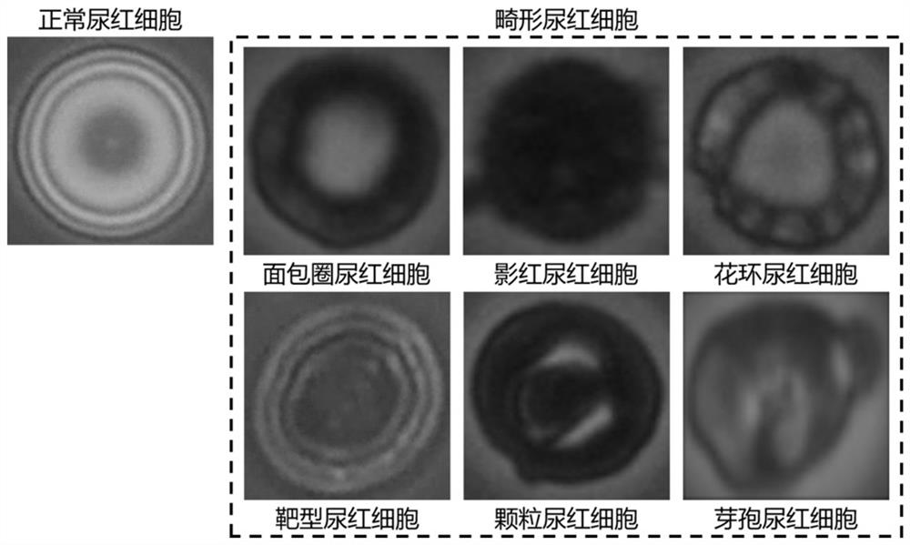 A kind of abnormal urine red blood cell classification statistical method and system