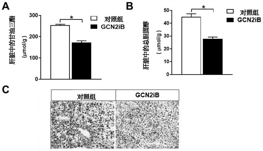 Application of compound shown in formula I in preparation of drug for treating obesity and related symptoms