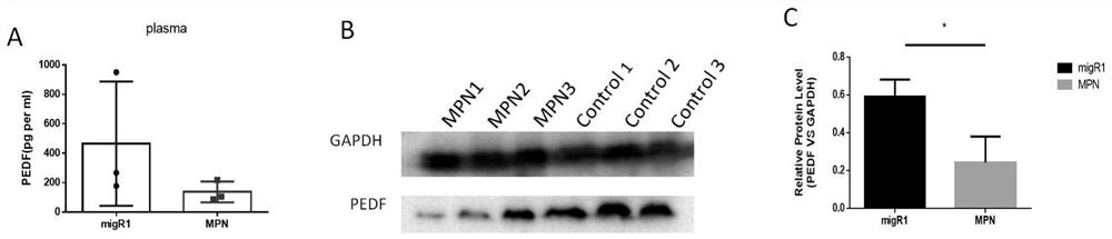 Application of pedf in preparation of medicine for treating myeloproliferative diseases