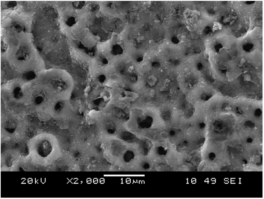 Preparation method for micro-arc oxidation-dopamine coupling carried traditional Chinese medicine coating of pure titanium oral implant