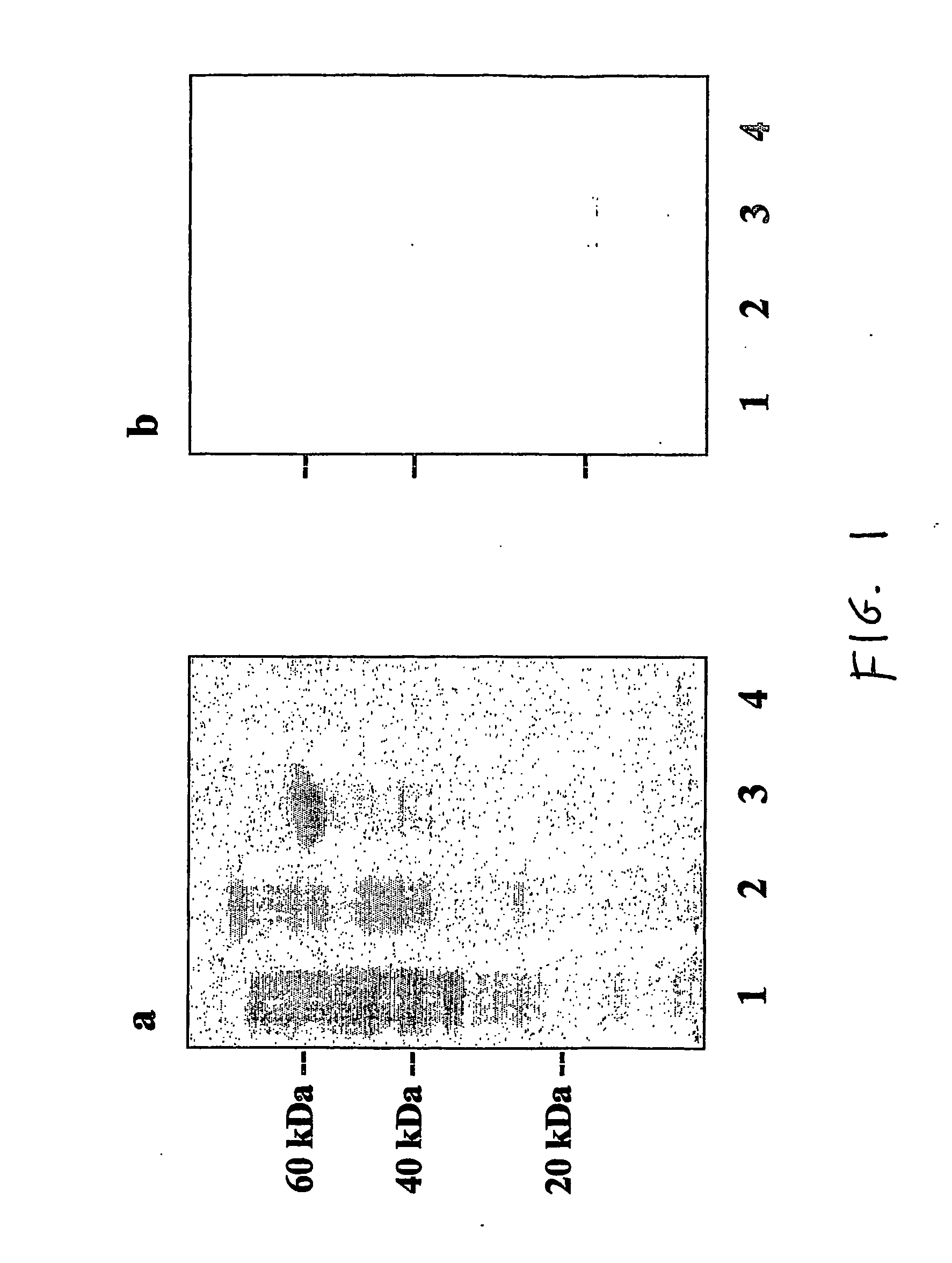 Staphylococcus aureus efb protein and c3 binding region which inhibit complement activation