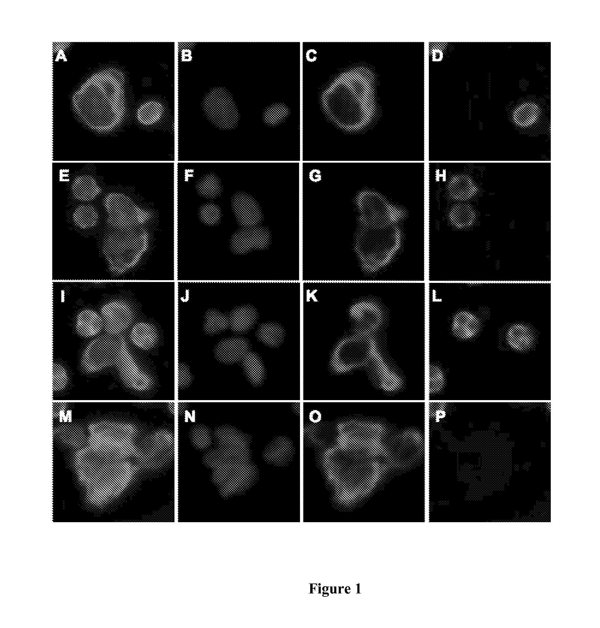 Circulating tumor cell diagnostics for lung cancer