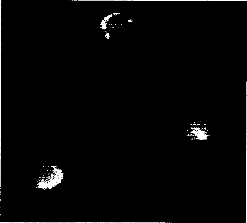 4-de-dimethyltetracycline derivative use