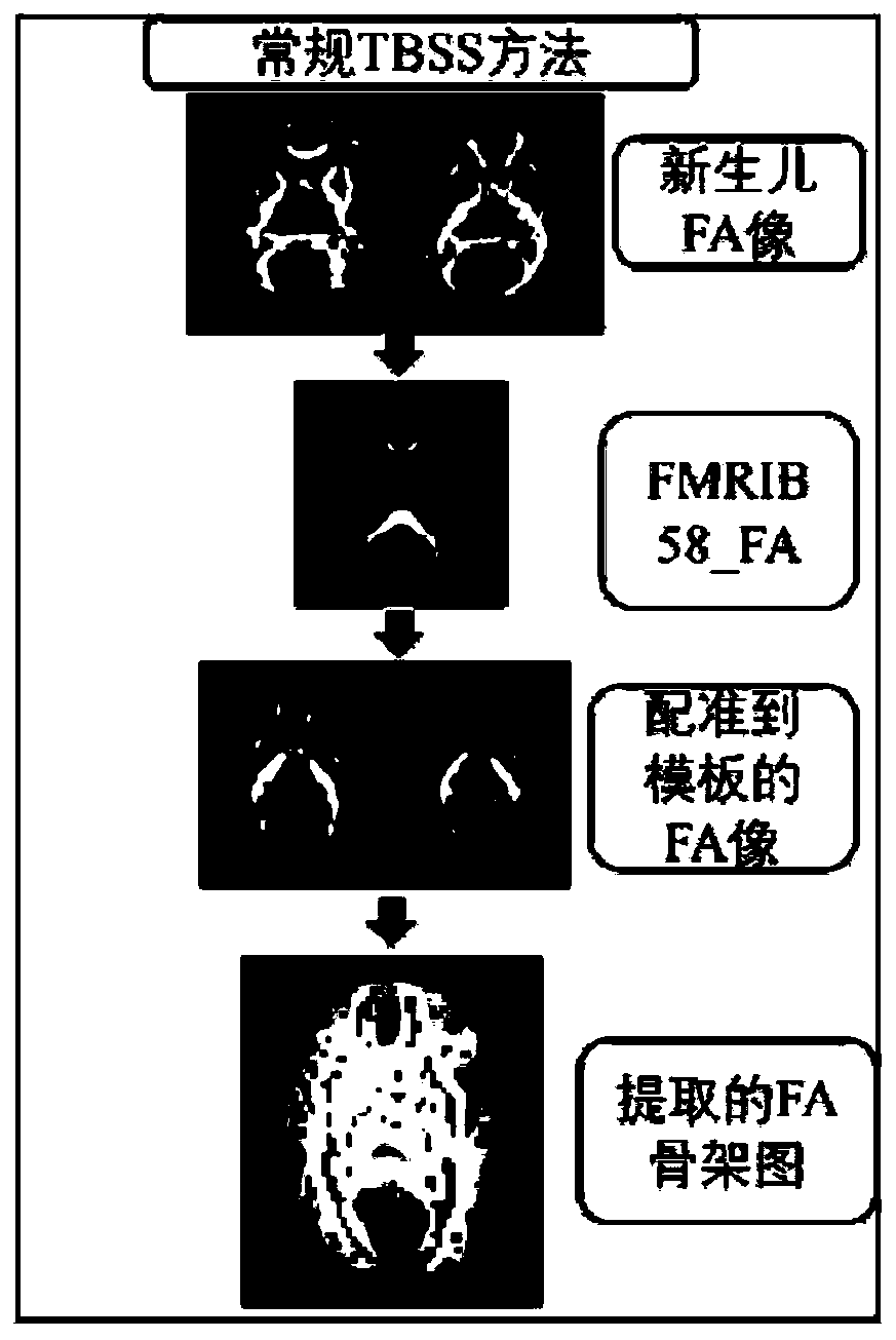 Magnetic resonance diffusion tensor brain image analysis method and system for newborns