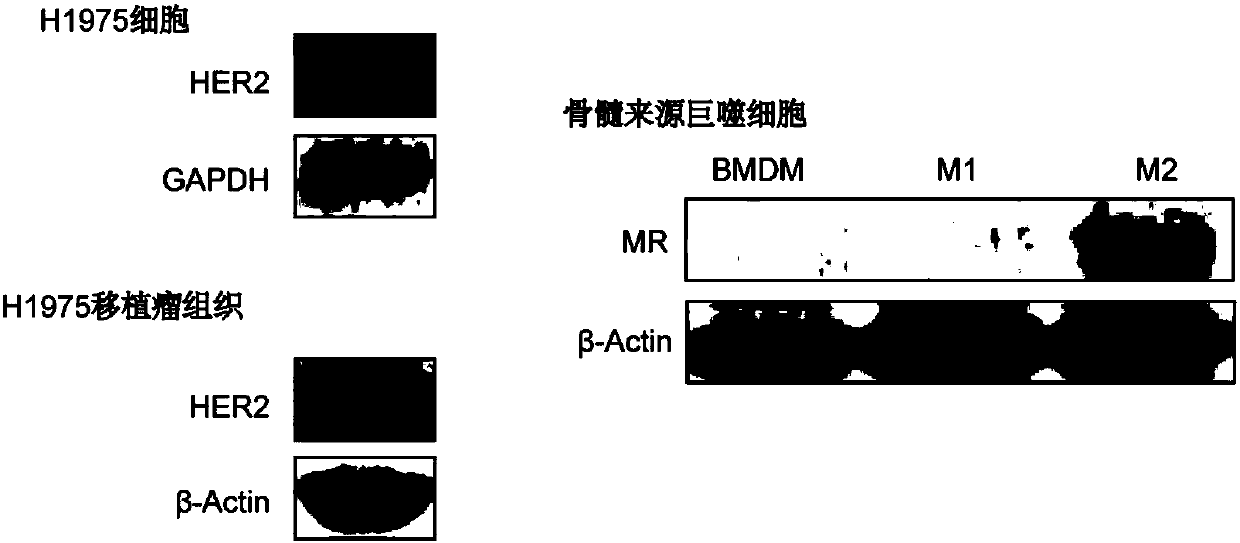 Pharmaceutical composition containing gefitinib and histone deacetylase inhibitor, lipidosome preparation of pharmaceutical composition, and pharmaceutical application of pharmaceutical composition and lipidosome preparation