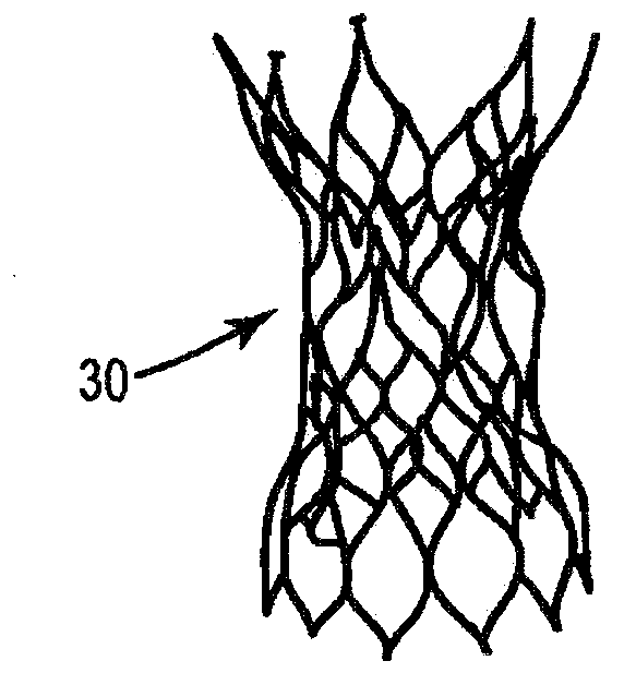 Stents for prosthetic heart valves